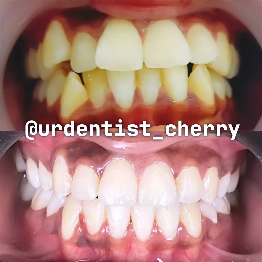 Snapinsta.app_447563982_768467832133523_5663907217062234513_n_1024