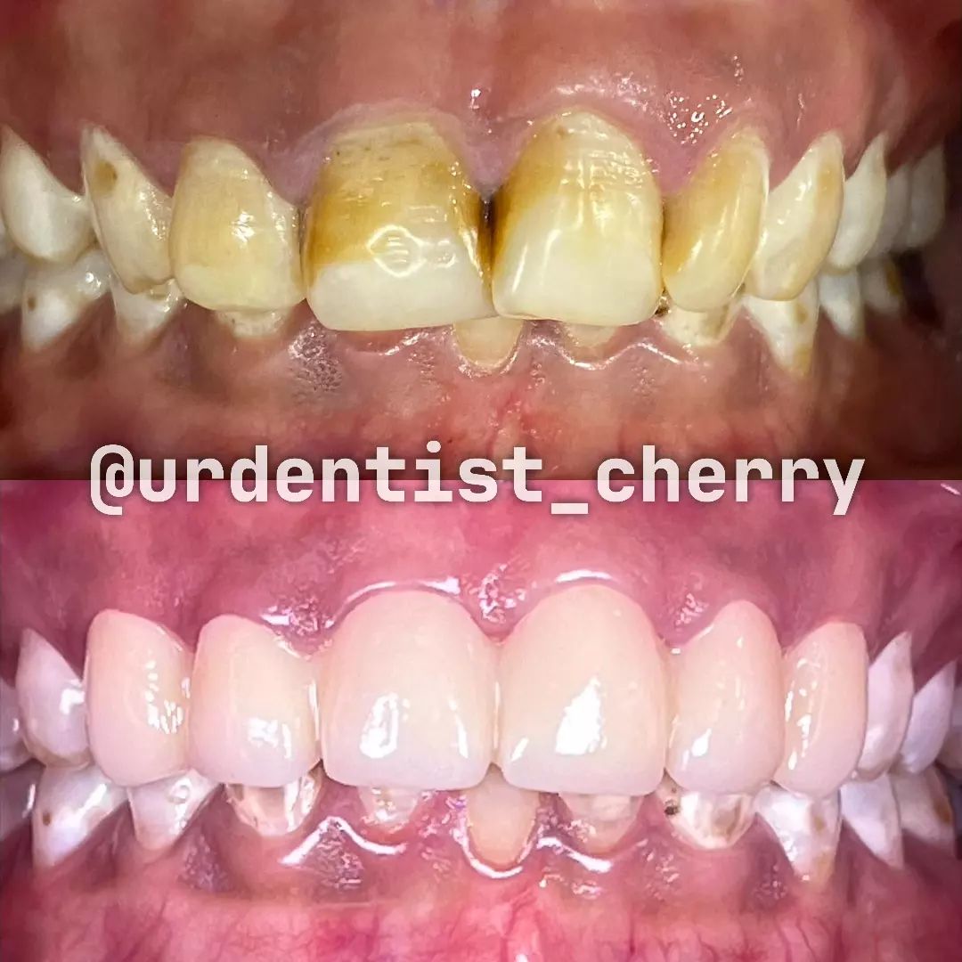 Snapinsta.app_449150122_1112926959782856_7700119486496497407_n_1080