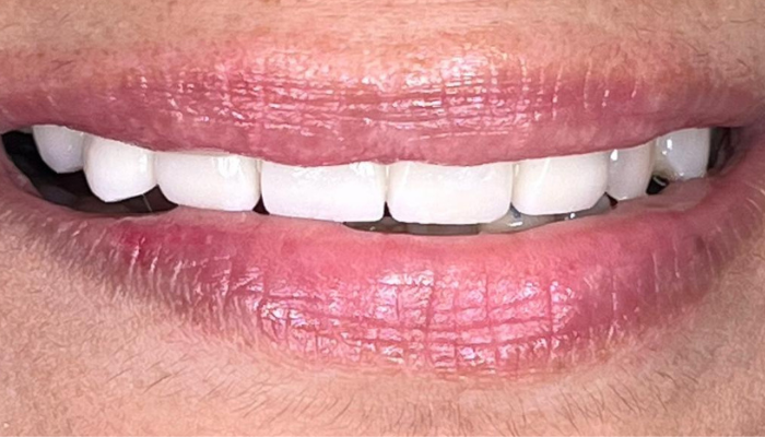 Untitled design (38)